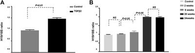 Knockdown of LncRNA-H19 Ameliorates Kidney Fibrosis in Diabetic Mice by Suppressing miR-29a-Mediated EndMT